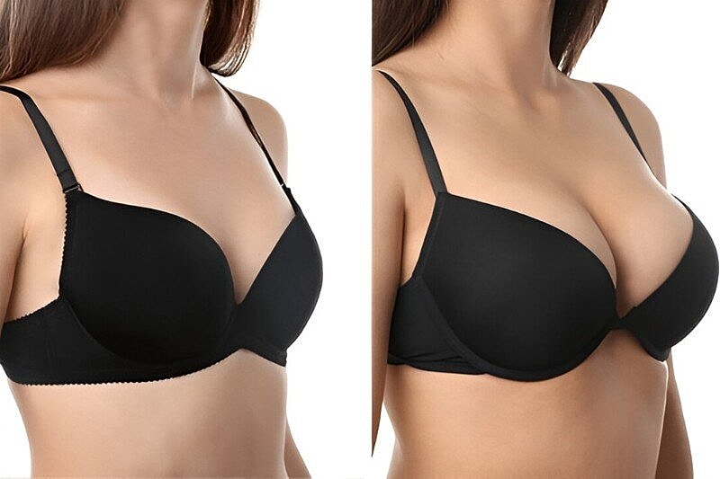 Breast Augmentation and Breast Implants: Costs, Risks and Recovery Tips