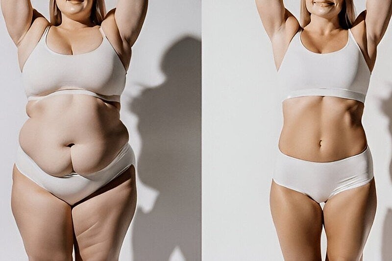 How Does Vaser® LipoSelection Work? Guide to Ultrasound Body Contouring