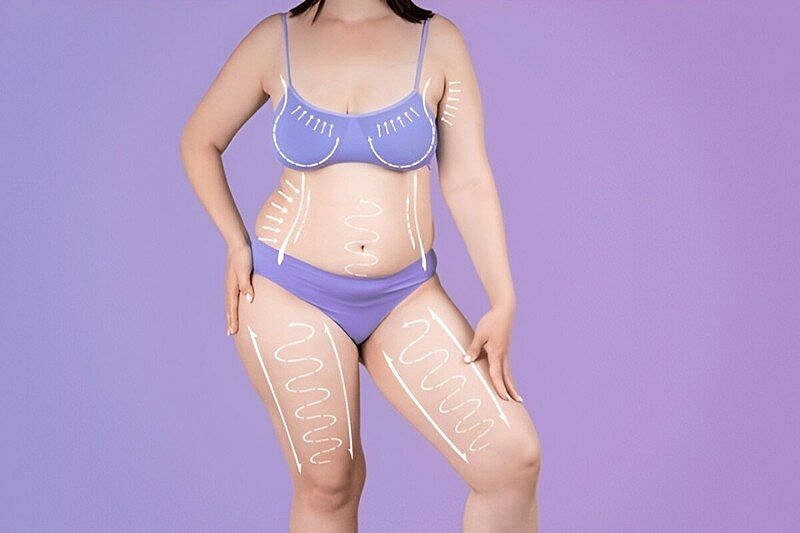How Pregnancy Cosmetically Changes Your Body? Mommy Makeover for Post-Pregnancy