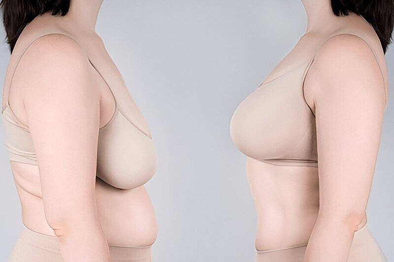 How Soon After Pregnancy Can I Get a Mommy Makeover? Procedure Scheduling Guide