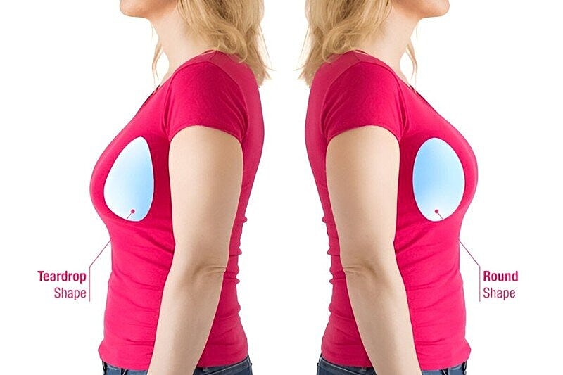 How to Pick the Right Breast Implant Size? Guidance, Tips, and Planning for the Right Fit