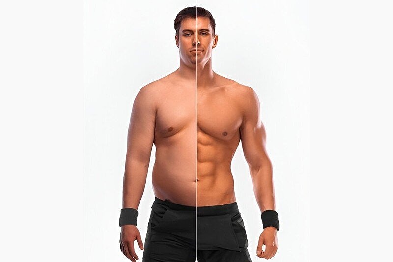 Male Breast Reduction Mammoplasty Tampa – Gynecomastia Options