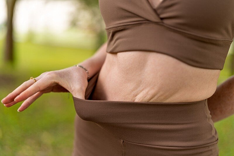 GLP-1 Ozempic and Wegovy Loose Skin Solutions in Tampa After Rapid Weight Loss