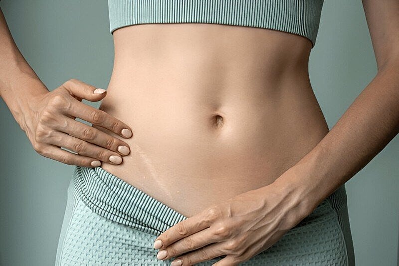 Scars: The Not-so-Pretty Side of Plastic Surgery – Tropical and Non-Invasive Treatments