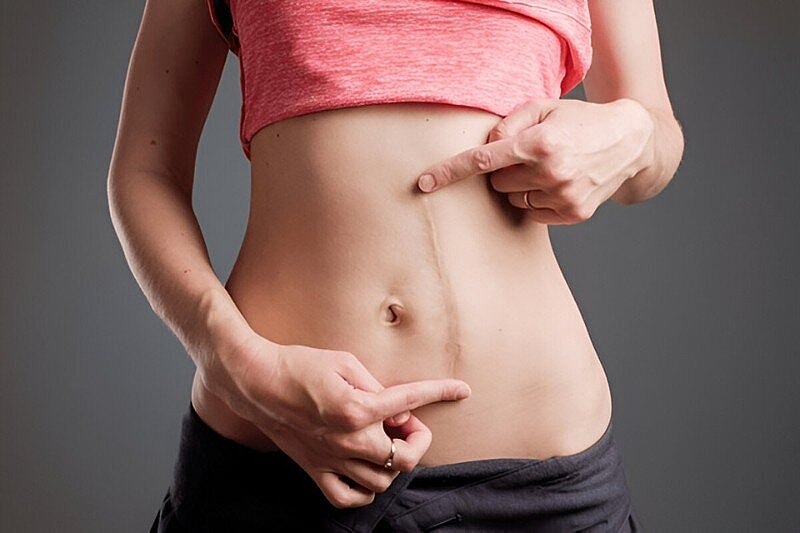 Clinically‑Backed Advanced Scar Removal and Management Techniques for Healthier Skin