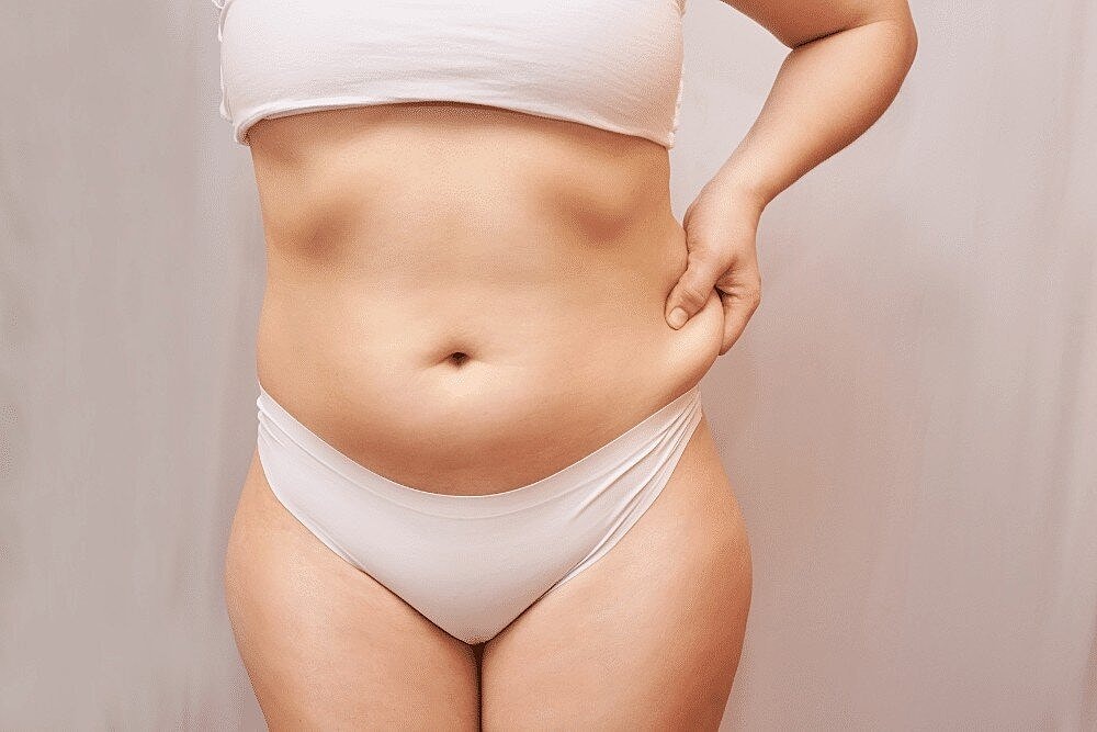 SmartLipo® vs. Traditional Liposuction: Key Differences and Recovery Timeline