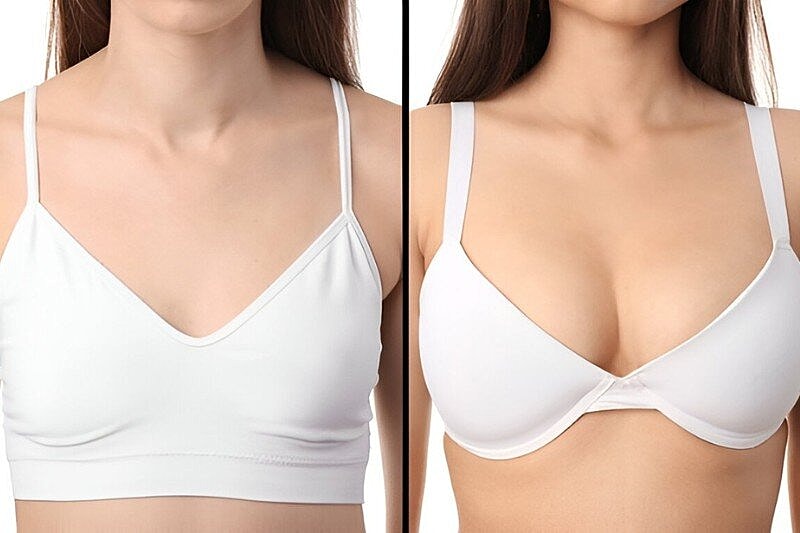 Top Benefits of Getting a Breast Lift – Refine Shape for a Youthful Silhouette