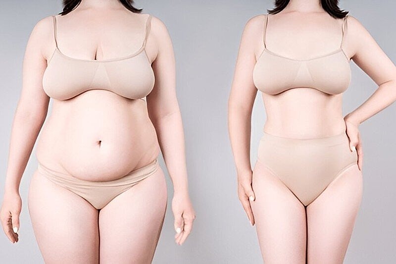 Vaser Liposuction Tampa – Advanced Fat Removal Method in Tampa, Florida