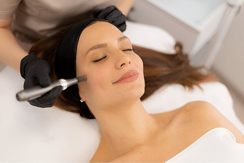 What Is the Skin Pen® Microneedling Treatment, and How Does It Work?