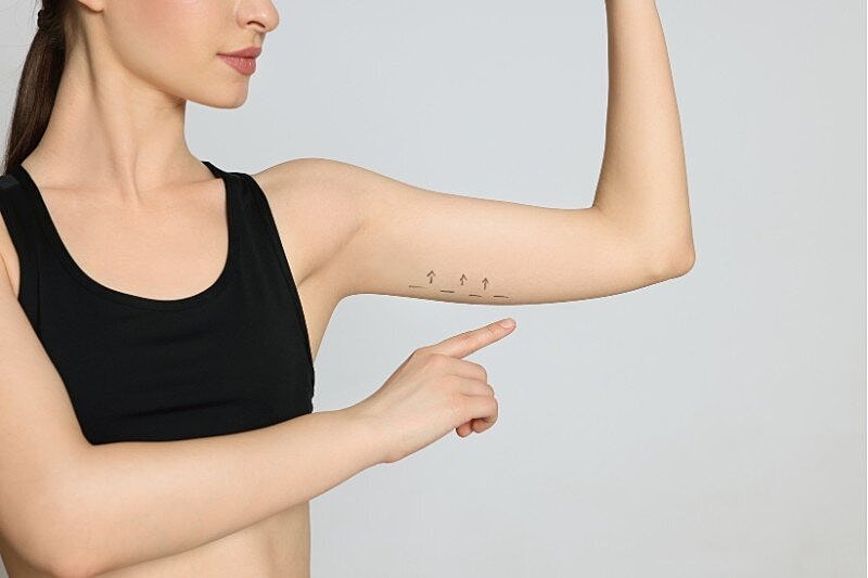Why Are My Upper Arms Flabby? Signs, Causes, and Reasons of Loose Arm Skin